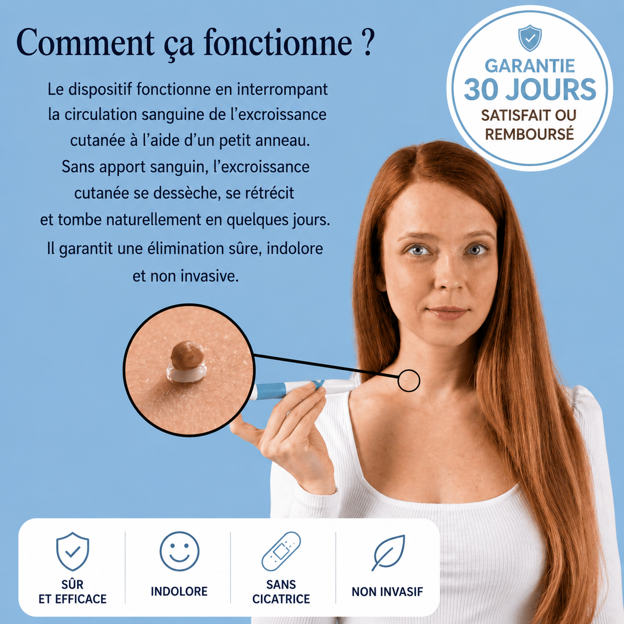 Derméa™ — Kit Anti-Acrochordons Sans Douleur